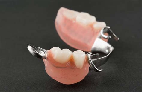 Tips For Getting Used To Your Partial Dentures Okamoto And Bigley