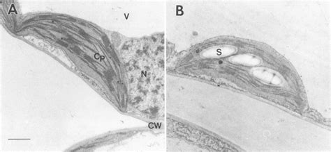 A, B. Transmission electron micrograph of chloroplasts of palisade ...