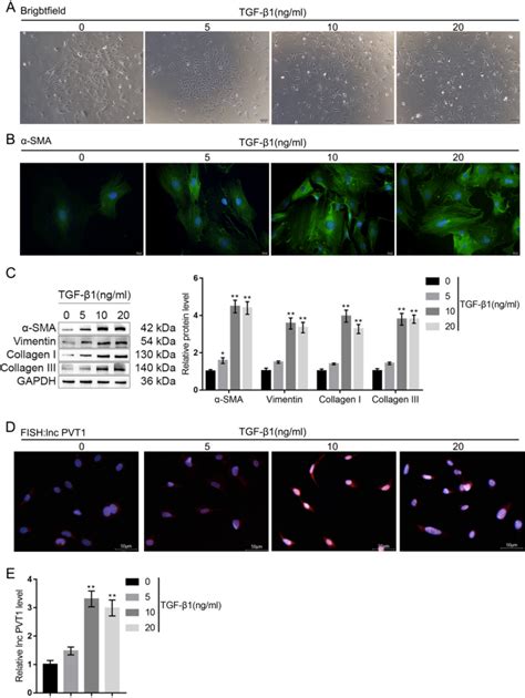 Lnc PVT1 facilitates TGF β1 induced human cardiac fibroblast activation