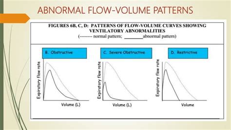 Spirometry