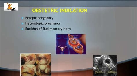 Laparoscopy In Pregnancy