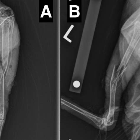 Ventrodorsal And Medio Lateral Radiographic Projections Taken