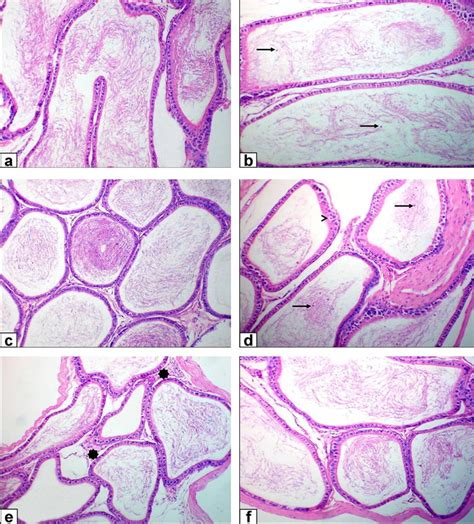 Photomicrograph Of Rat Epididymis Stained With He × 200 Scale