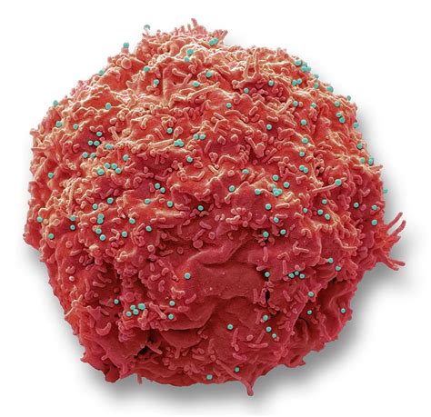 Hiv Infected Cell Photograph By Steve Gschmeissnerscience Photo