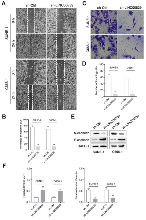 Linc Knockdown Restrains The Metastatic Behavior Of Nasopharyngeal