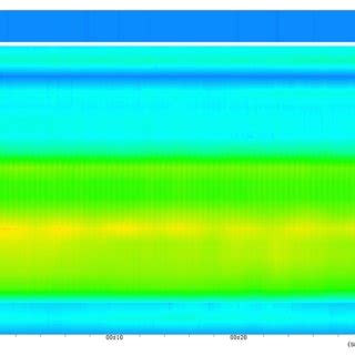 The High Resolution Manometry Image Anal Canal Resting Pressure