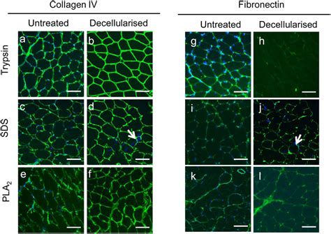 Differential Preservation Of Collagen Iv And Fibronectin In Sections