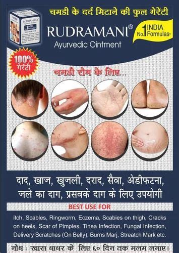 Rudramani Ayurvedic Ointment 25gm Packaging Type Box At Rs 100 In Surat