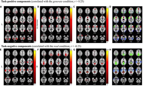 Frontiers Sex Age And Handedness Modulate The Neural Correlates Of