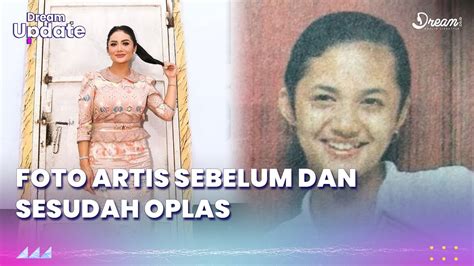 Foto Artis Sebelum Dan Sesudah Oplas Youtube