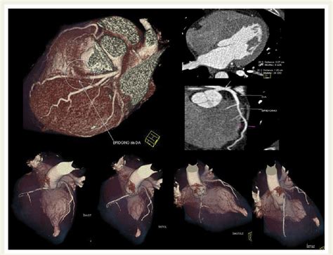 Figure From Role Of Multimodality Cardiac Imaging In The Management