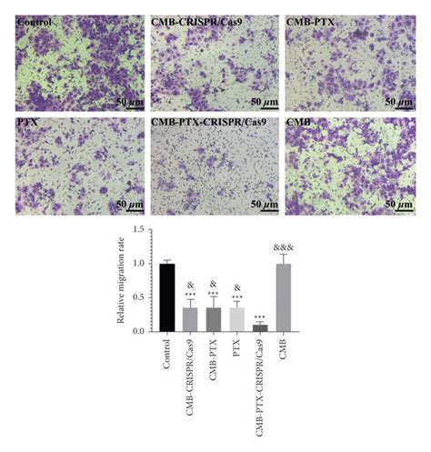 Relative Invasion Rate Was Evaluated By Transwell Assay In The Naked