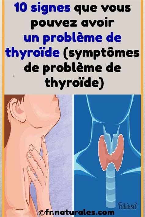 10 signes que vous pouvez avoir un problème de thyroïde symptômes de