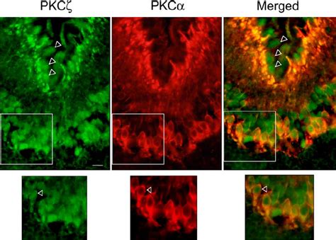 Pkc ζ And Pkc α Localization 18 H After Intravitreal Nmda Injection