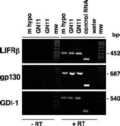 RT PCR Analysis Of LIFR And Gp130 Gene Expression The Two Subunits