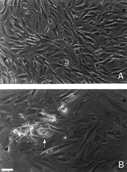 Phase Contrast Microscopy Of Cultured Stromal Cells Download Scientific Diagram