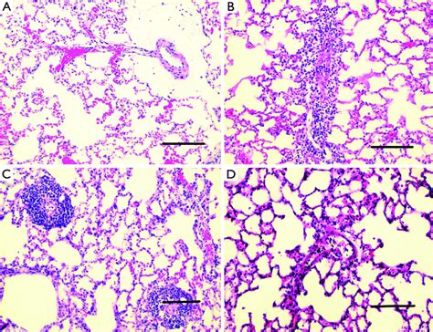 Hematoxylin And Eosin Stained Lung Sections Of Each Experimental Groups Download Scientific