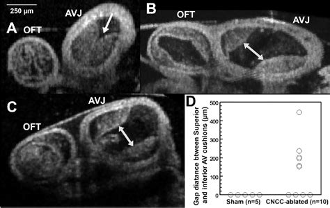 Figure 6 From Cardiac Neural Crest Ablation Results In Early