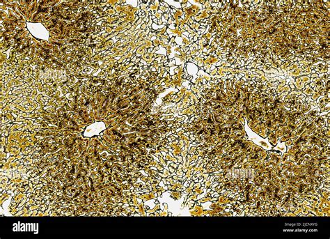 Light Micrograph Of Liver Tissue Showing Radial Cords Of Hepatocytes