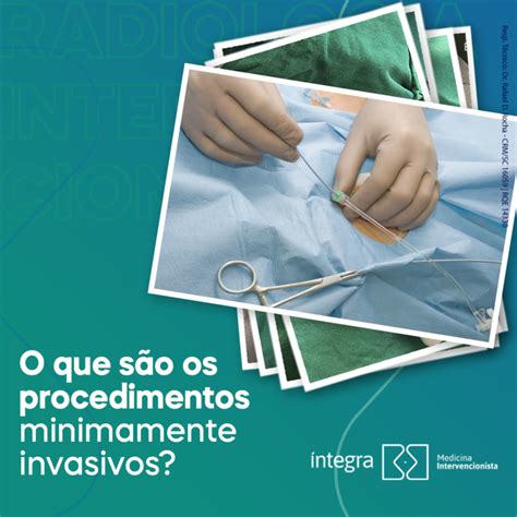 O Que S O Procedimentos Minimamente Invasivos Dica M Dica