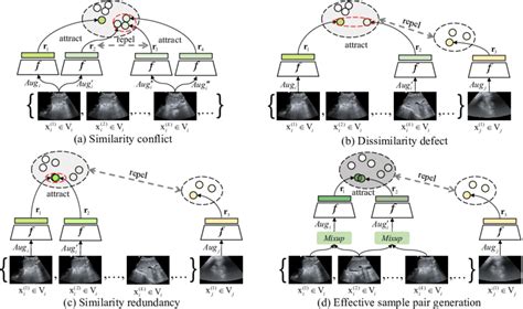 Motivation Of Our Ultrasound Contrastive Learning Approach A Download Scientific Diagram