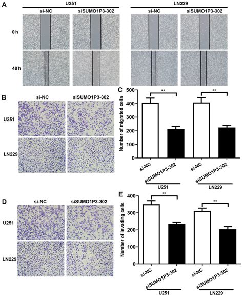 Sumo P Knockdown Represses Cell Migration And Invasion In Vitro A