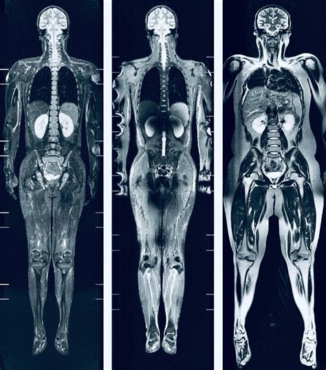 Spezielle Untersuchungen Radiologie Filstal