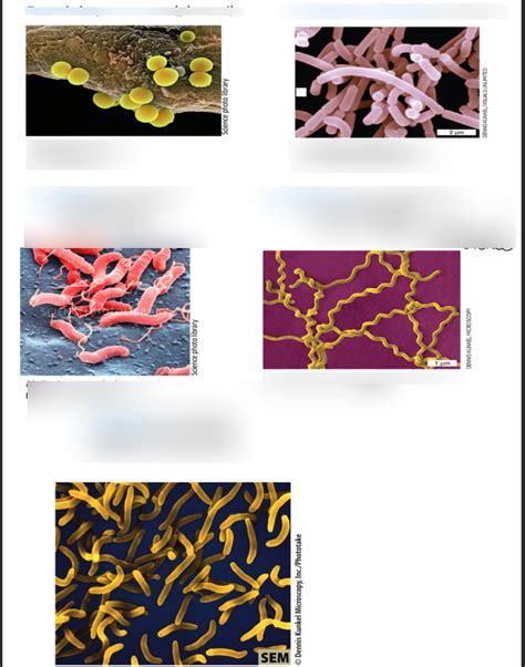 Cell Morphology Diagram Quizlet