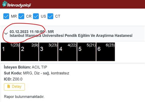 Marmara Niversitesi Pendik E Itim Ve Ara T Rma Hastanesi Mr Sonucunun