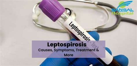 Understanding Leptospirosis Symptoms Causes And Treatment By Toneop Artical Medium