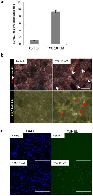 Bile Acids Induce Activity Of P53 Pathway In Vitro Aml12 Cells Were