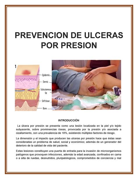 Prevenci N De Lceras Por Presi N Introducci N La Lcera Por Presi N Se