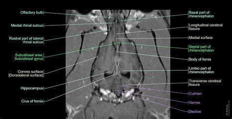 Canine Brain MRI Atlas - Veterinary Radiology: normal anatomy | vet-Anatomy