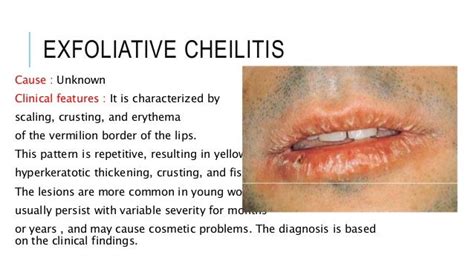 Lip Lesion Oral Medicine