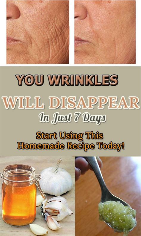 She Removed All Wrinkles Using This Homemade Cream In Only 1 Week