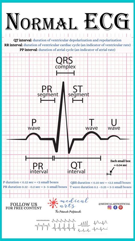 Normal ECG Cheatsheet Flashcard | Normal ecg, Basic anatomy and physiology, Nursing survival kit