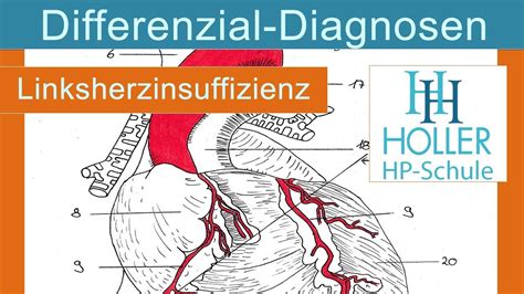 Differenzialdiagnose Ursachen Linksherzinsuffizienz Youtube