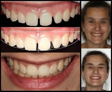 Diseño Digital de Sonrisas ven a ver tu nueva sonrisa Clinica Aguilar