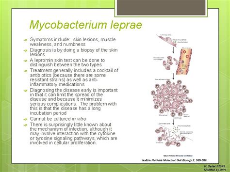 Mycobacterium Leprae Causative Agent Of Leprosy Aka Hansens