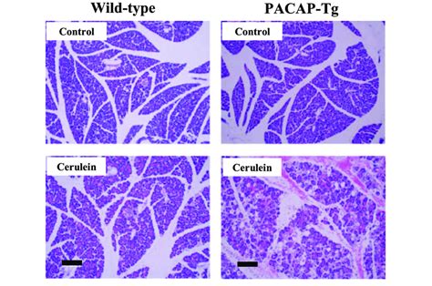 Histological Examinations Of Pancreas Of Cerulein Treated Mice Download Scientific Diagram