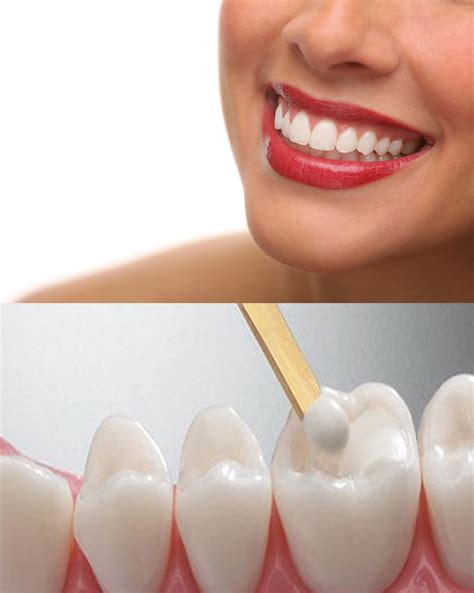 White Fillings Dental Health Centre