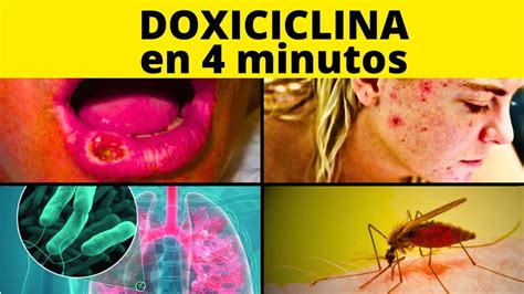 Descubre Para Qu Sirve La Doxiciclina Mg En Adultos Y Mucho M S