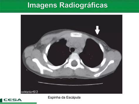 Aula Radiologia Anatomia Do Esqueleto Apendicular Cintura