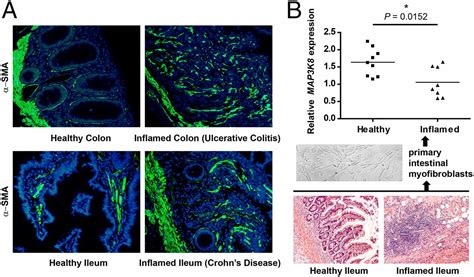 Intestinal Myofibroblast Specific Tpl2 Cox 2 Pge2 Pathway Links Innate