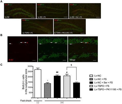 Frontiers The Kda Translocator Protein Tspo Overexpression In