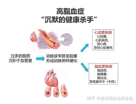 中国高血脂人群约1亿人，你在其中吗？ 知乎