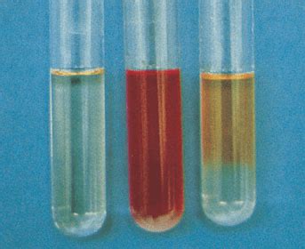 Methyl Red Test (MR) - Principle, Procedure, Interpretation