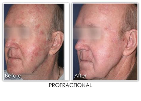 Lasers Skin Rejuvenation Clinic Skin Rejuvenation Clinic