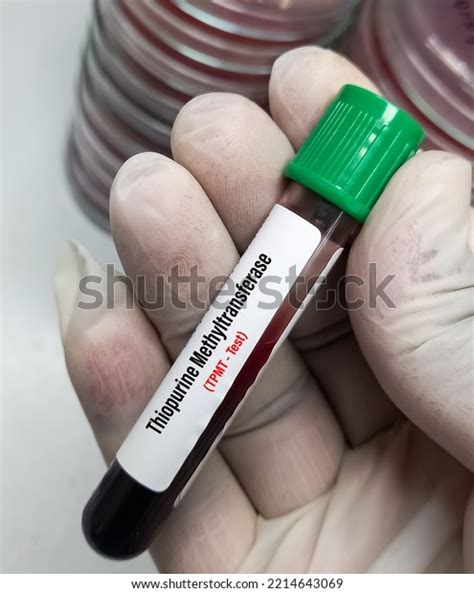 Blood Sample Thiopurine Methyltransferasetpmt Test Thiopurine Stock Photo 2214643069 | Shutterstock