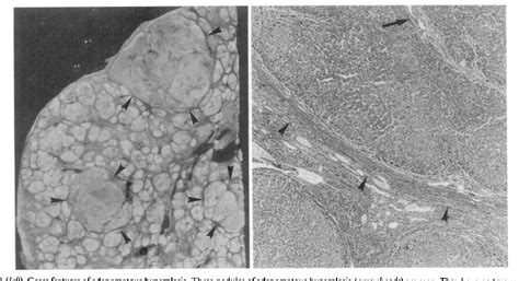 Figure From Argyrophilic Nucleolar Organizer Regions And Alpha